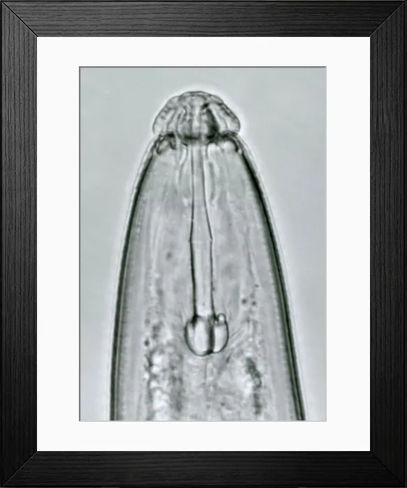 Framed Print : Nematode under a microscope Framed Print : Nematode under a microscope