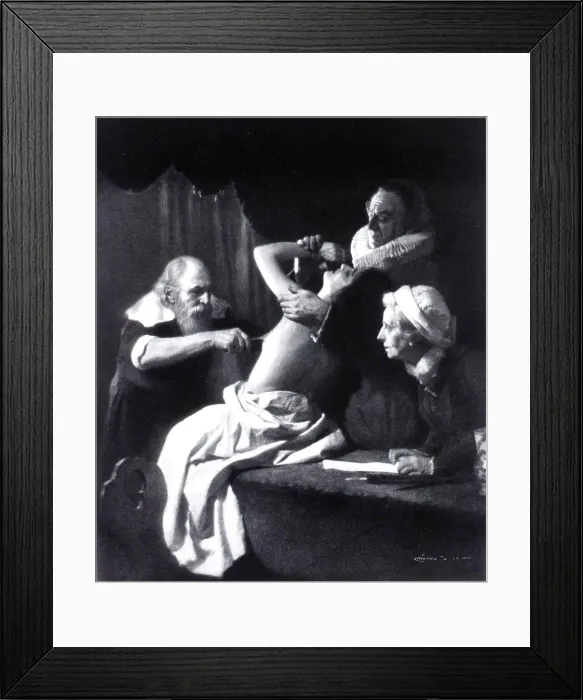 Framed Print : Wilhelm Fabry, German Surgeon Framed Print : Wilhelm Fabry, German Surgeon