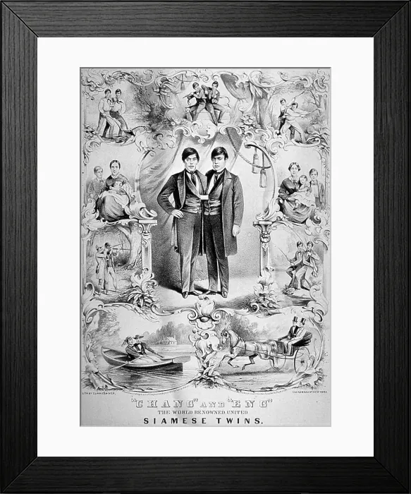 Framed Print : Chang and Eng Bunker, The Original Siamese Twins Framed Print : Chang and Eng Bunker, The Original Siamese Twins