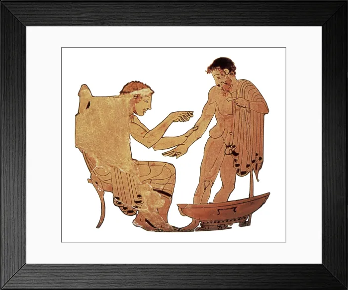 Framed Print : Bloodletting of Ancient Greek Patient, 480-470 BC Framed Print : Bloodletting of Ancient Greek Patient, 480-470 BC