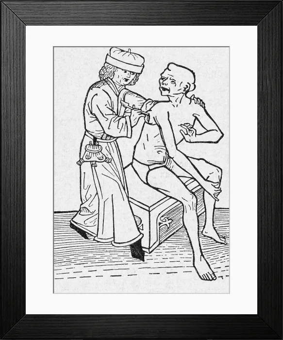 Framed Print : Physician Lancing Wound Framed Print : Physician Lancing Wound