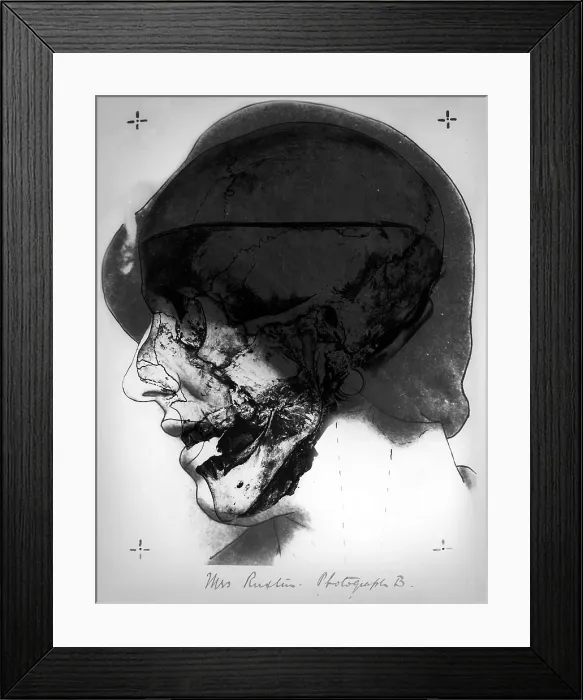 Framed Print : Forensic Evidence, Buck Ruxton Murder Trial, 1935 Framed Print : Forensic Evidence, Buck Ruxton Murder Trial, 1935