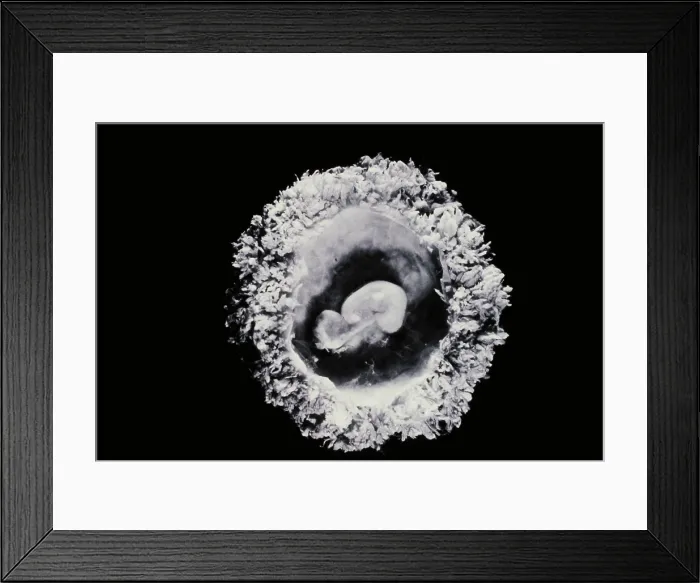 Framed Print : Human embryo Framed Print : Human embryo
