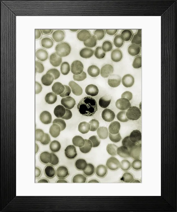 Framed Print : Leukocyte, Drumstick, light micrograph Framed Print : Leukocyte, Drumstick, light micrograph