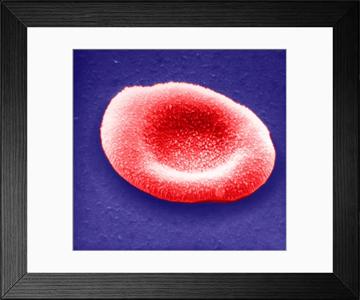 Framed Print : Red Blood Cell, under a microscope (SEM)
