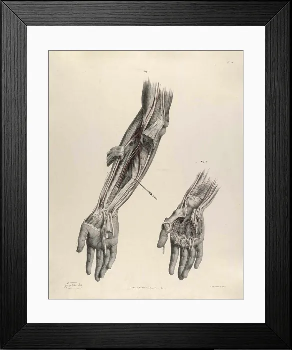 Framed Print : Historical Anatomical Illustration Framed Print : Historical Anatomical Illustration