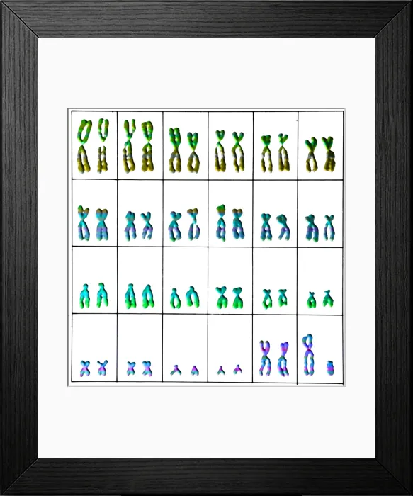 Framed Print : Karyotype, Normal Male Chromosomes Framed Print : Karyotype, Normal Male Chromosomes