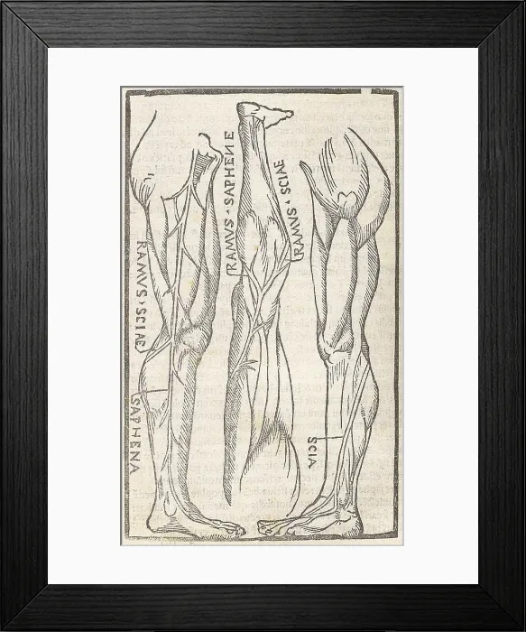 Framed Print : Jacopo Berengario da Carpi, Anatomy Framed Print : Jacopo Berengario da Carpi, Anatomy