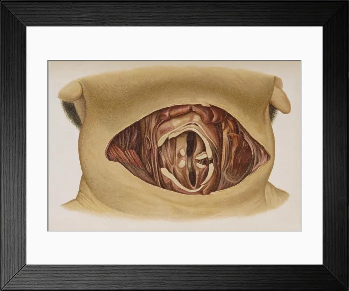 Framed Print : Suicide by Cutting the Throat, 1898 Framed Print : Suicide by Cutting the Throat, 1898