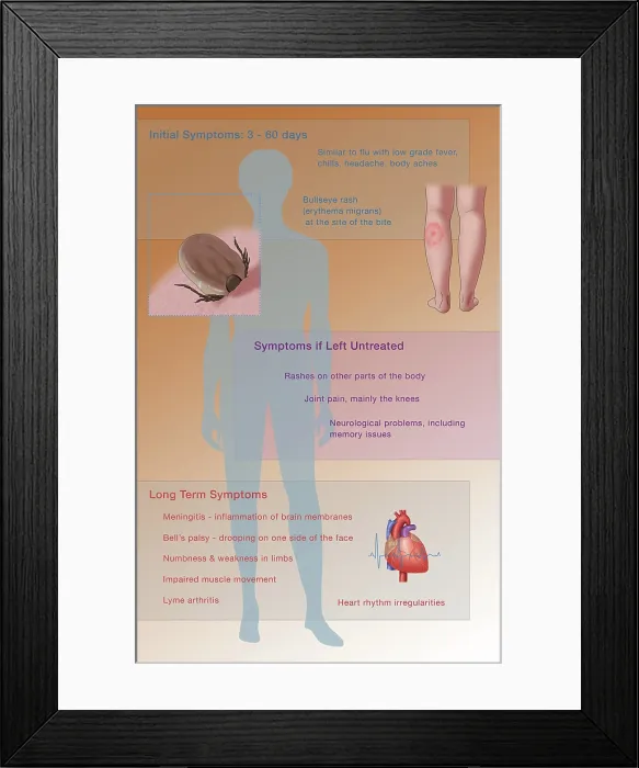 Framed Print : Symptoms of Lyme Disease, Illustration