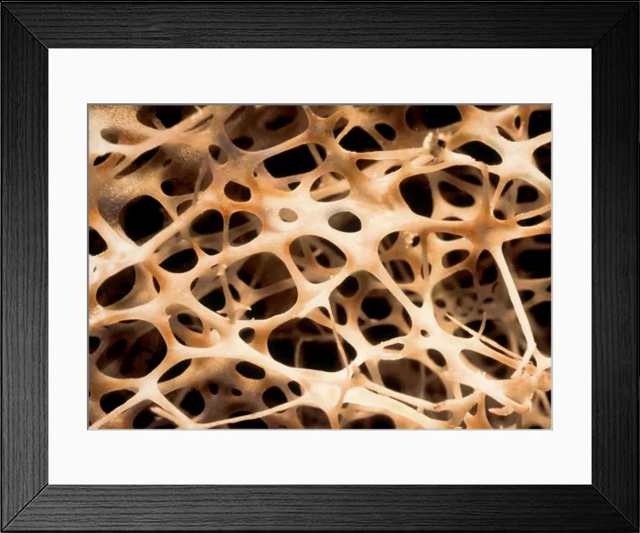 Framed Print : Shin Connecting Bones SEM Framed Print : Shin Connecting Bones SEM