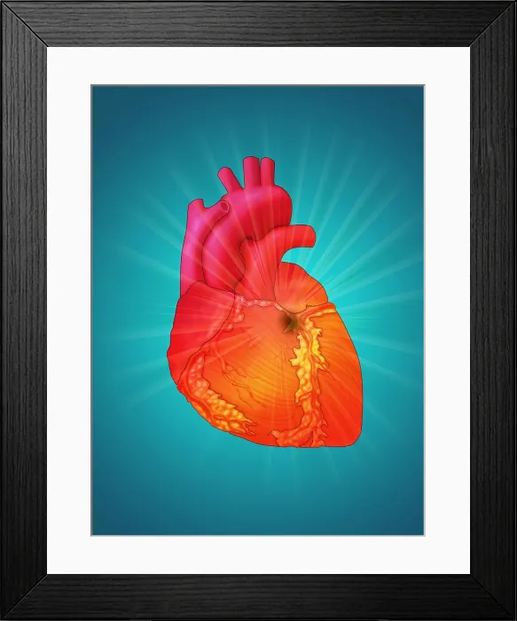 Framed Print : Heart Attack, Conceptual Illustration Framed Print : Heart Attack, Conceptual Illustration