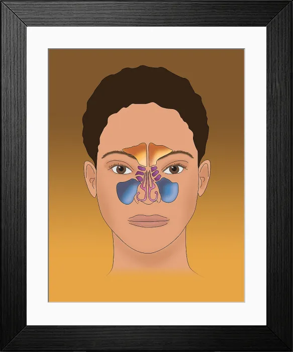 Framed Print : Paranasal sinus anatomy, maxillary, frontal, sphenoid, ethmoid cavities, illustration