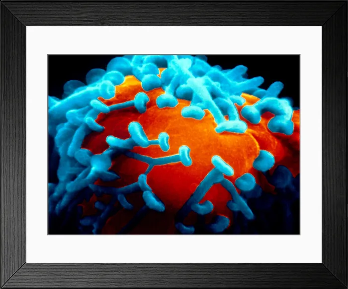 Framed Print : Motor Nerve, Synapses, under a microscope (SEM) Framed Print : Motor Nerve, Synapses, under a microscope (SEM)