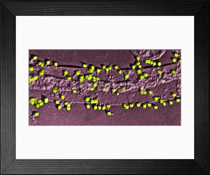 Framed Print : Bacteriophage T-2 Infecting E. coli Cell Wall, TEM