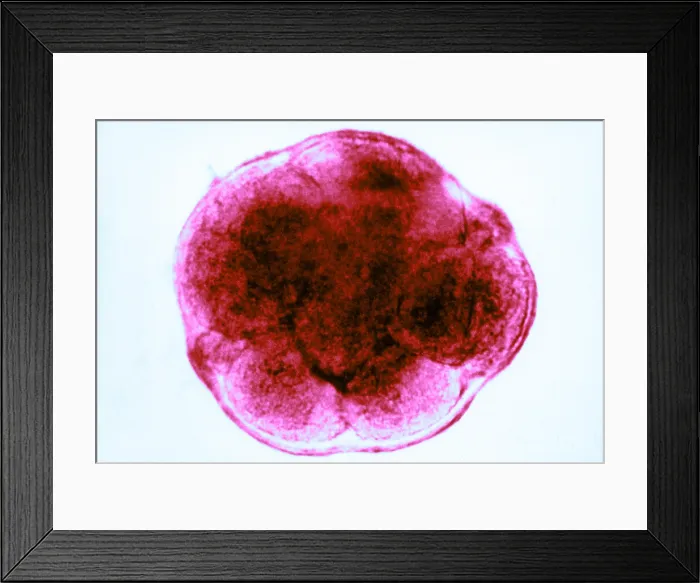 Framed Print : Human Reproduction, Ovum, 8-Cell Stage, light micrograph Framed Print : Human Reproduction, Ovum, 8-Cell Stage, light micrograph