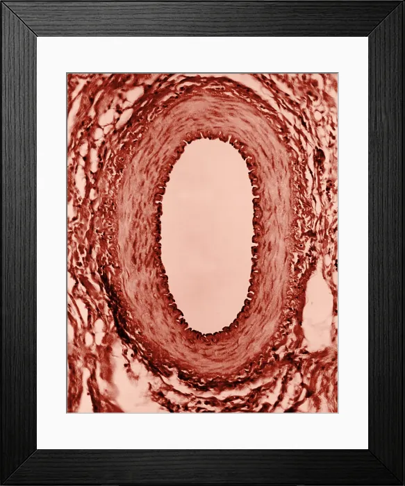 Framed Print : Circulatory System, Healthy Artery, TEM Framed Print : Circulatory System, Healthy Artery, TEM