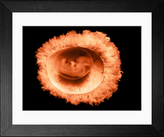 Framed Print : 45 day old human embryo Framed Print : 45 day old human embryo