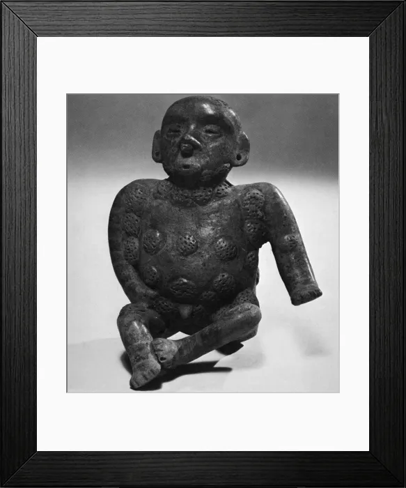 Framed Print : Figure Showing Syphilis Symptoms