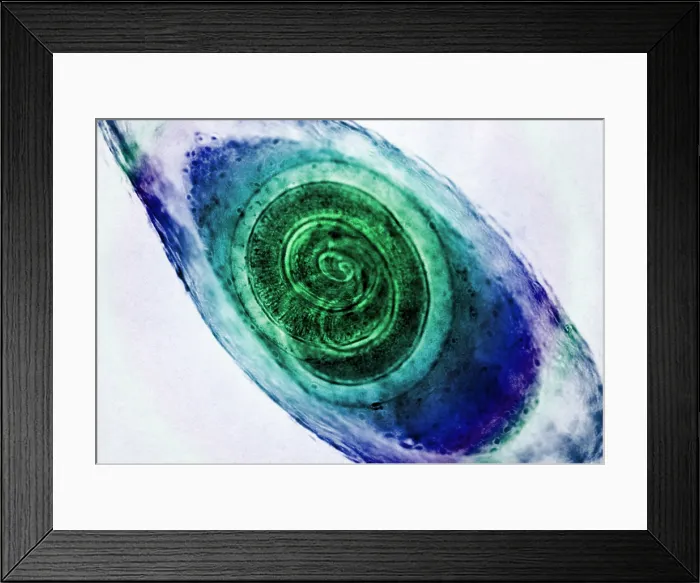Framed Print : Trichinella in Muscle, light micrograph Framed Print : Trichinella in Muscle, light micrograph