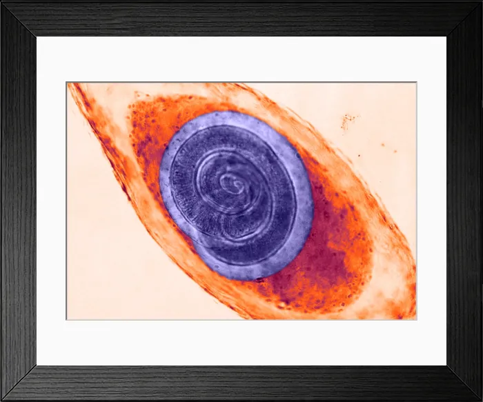 Framed Print : Trichinella in Muscle (LM) under a microscope
