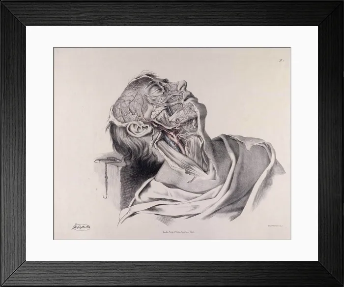 Framed Print : Historical Anatomical Illustration Framed Print : Historical Anatomical Illustration
