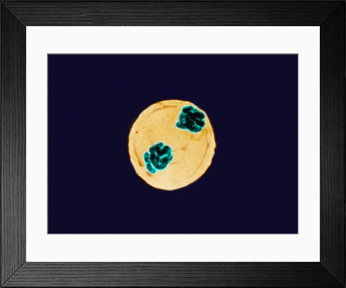 Framed Print : Anaphase of Mitosis in Trillium Cell Framed Print : Anaphase of Mitosis in Trillium Cell
