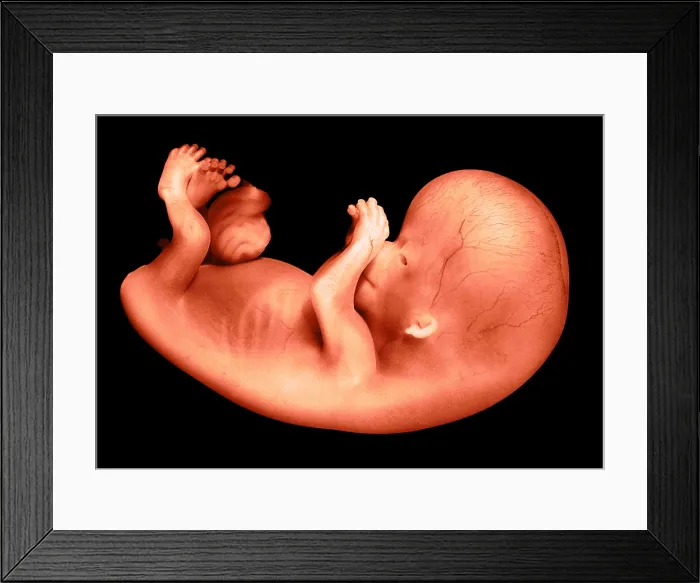 Framed Print : 56 day old human fetus Framed Print : 56 day old human fetus