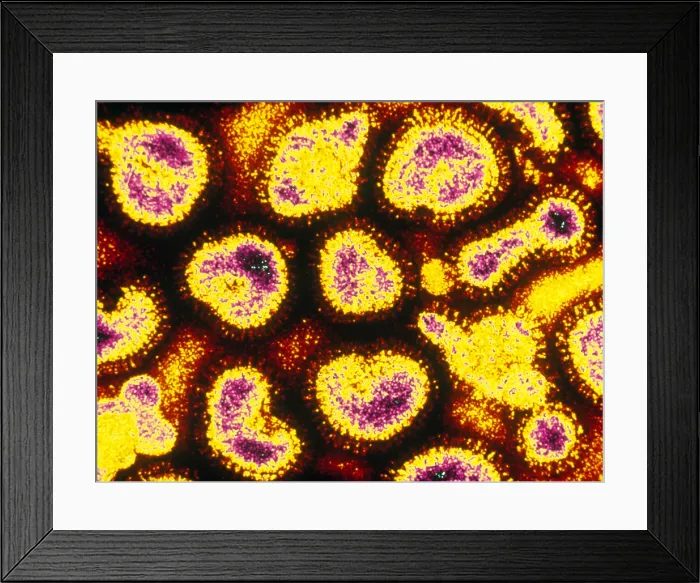 Framed Print : Influenza (TEM) Framed Print : Influenza (TEM)