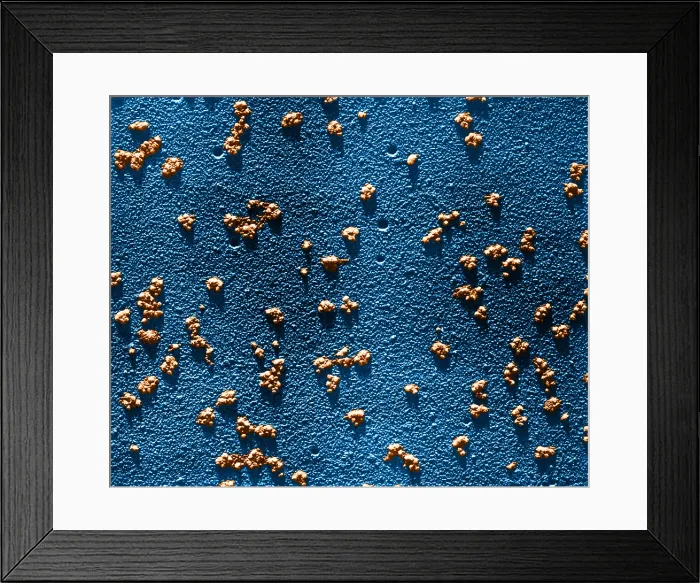 Framed Print : Immature RBCs, Reticulocyte Polyribosomes, TEM Framed Print : Immature RBCs, Reticulocyte Polyribosomes, TEM