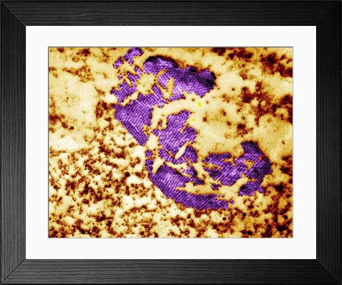 Framed Print : Human Enterovirus, Poliovirus, TEM Framed Print : Human Enterovirus, Poliovirus, TEM