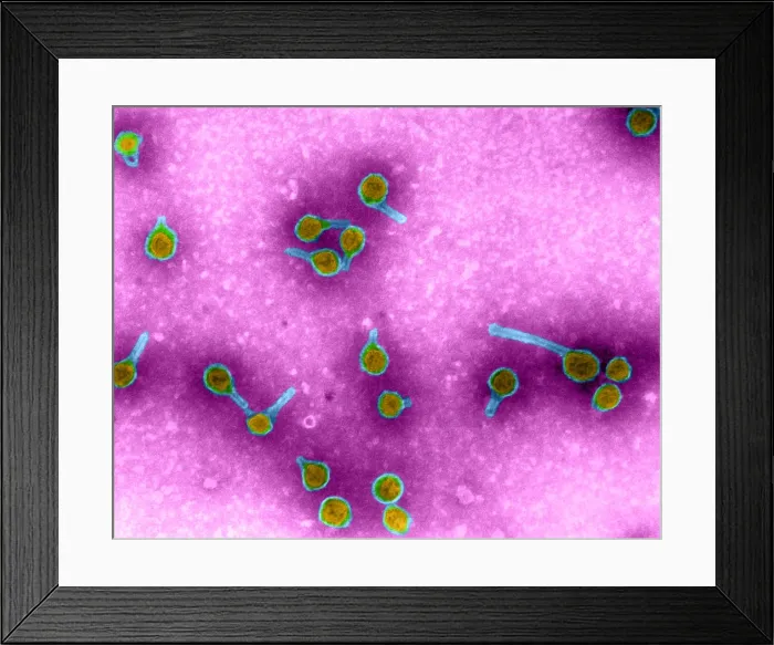 Framed Print : Rauscher Leukemia Virus, TEM Framed Print : Rauscher Leukemia Virus, TEM