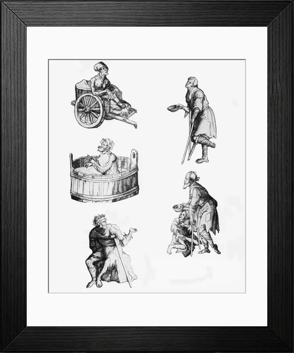 Framed Print : People With Leprosy Framed Print : People With Leprosy