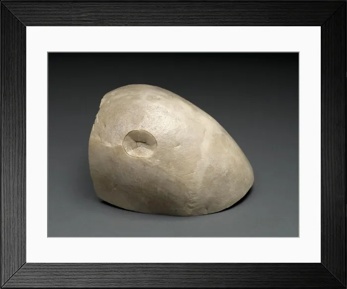 Framed Print : Blunt Force Ball-Peen Hammer Trauma to Skull, 1950's Framed Print : Blunt Force Ball-Peen Hammer Trauma to Skull, 1950's