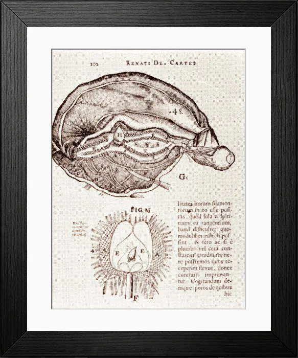 Framed Print : Brain and Pineal Gland Framed Print : Brain and Pineal Gland