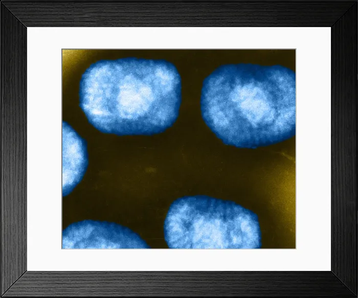 Framed Print : Vaccinia Virus, Eradicated Smallpox, TEM