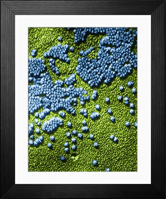 Framed Print : Hepatitis Virus