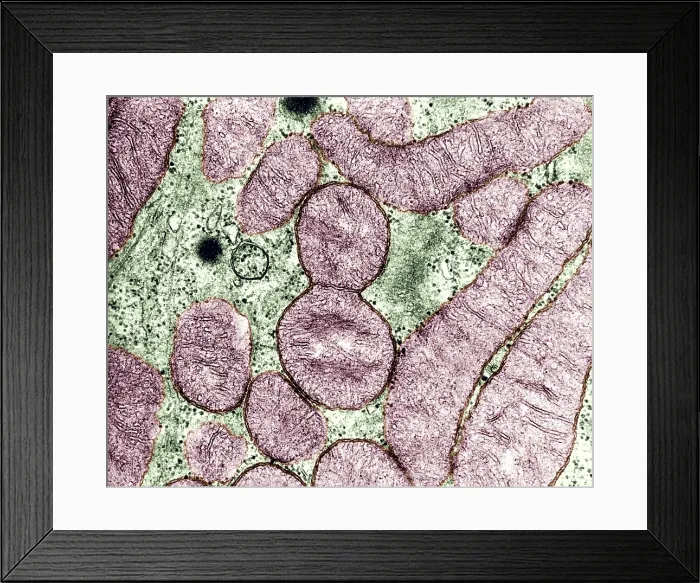 Framed Print : Dividing Mitochondrion, TEM