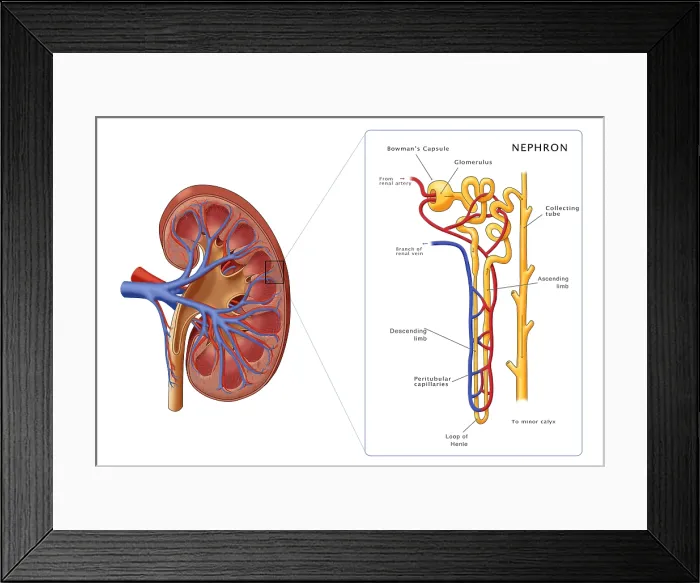 Framed Print : Kidney and Nephron, Illustration Framed Print : Kidney and Nephron, Illustration