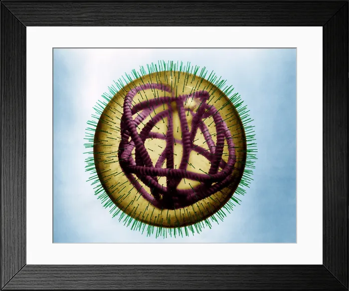 Framed Print : MeV, Measles Virus