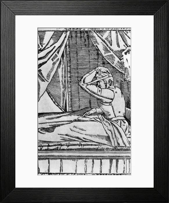 Framed Print : Tagliacozzi's Method of Growing New Nose from Arm Skin Framed Print : Tagliacozzi's Method of Growing New Nose from Arm Skin