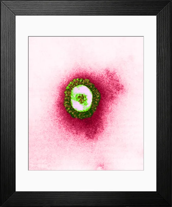 Framed Print : Coronavirus, TEM Framed Print : Coronavirus, TEM