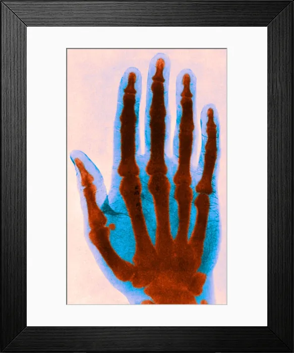 Framed Print : Early X-ray