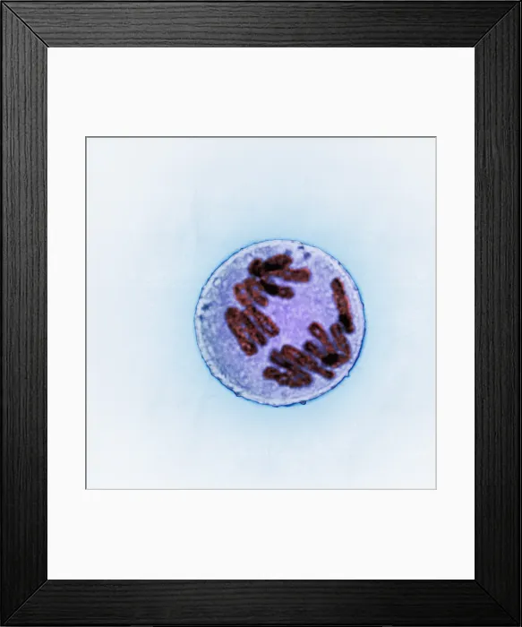 Framed Print : Anaphase of Mitosis in Trillium Cell