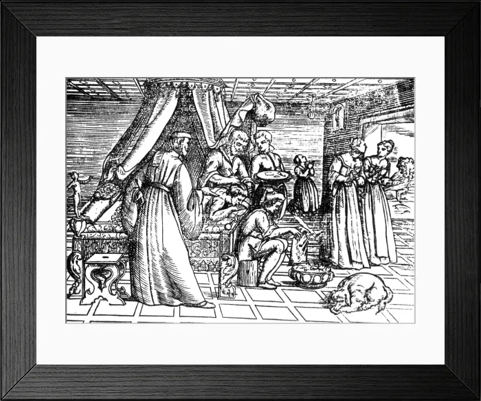 Framed Print : Trepanning, 1573 Framed Print : Trepanning, 1573