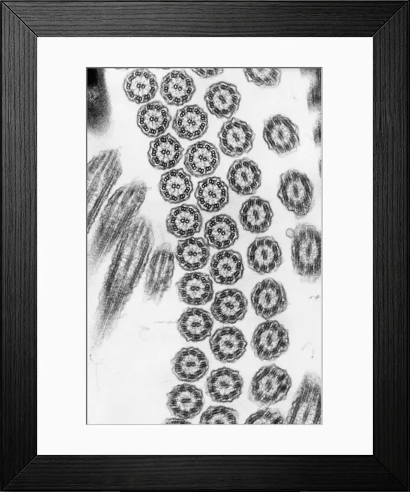 Framed Print : Cilia from Ciliates (TEM) Framed Print : Cilia from Ciliates (TEM)