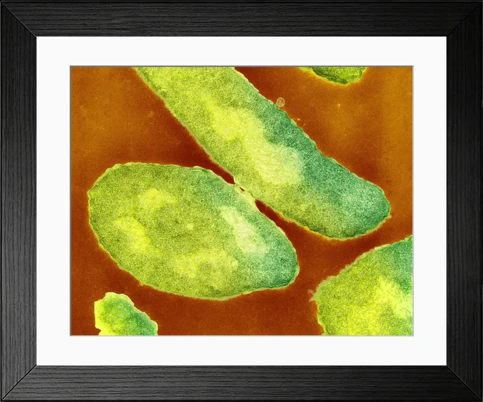 Framed Print : Bacteria, Genetic Recombination, TEM Framed Print : Bacteria, Genetic Recombination, TEM