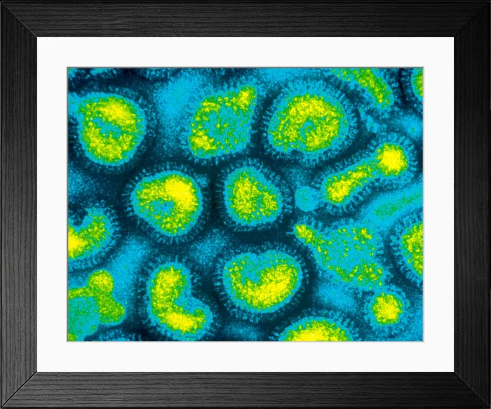Framed Print : Influenza Viruses, TEM