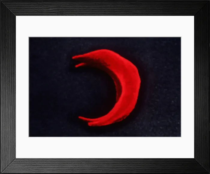 Framed Print : SCD, Sickle-Cell Anemia, under a microscope (SEM) Framed Print : SCD, Sickle-Cell Anemia, under a microscope (SEM)