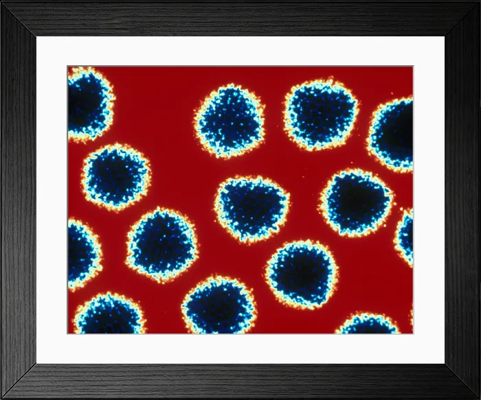 Framed Print : Adenovirus, TEM Framed Print : Adenovirus, TEM